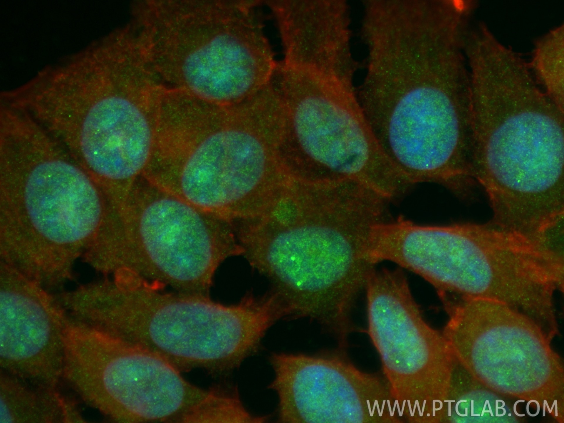 Immunofluorescence (IF) / fluorescent staining of MCF-7 cells using RAD50 Polyclonal antibody (29390-1-AP)
