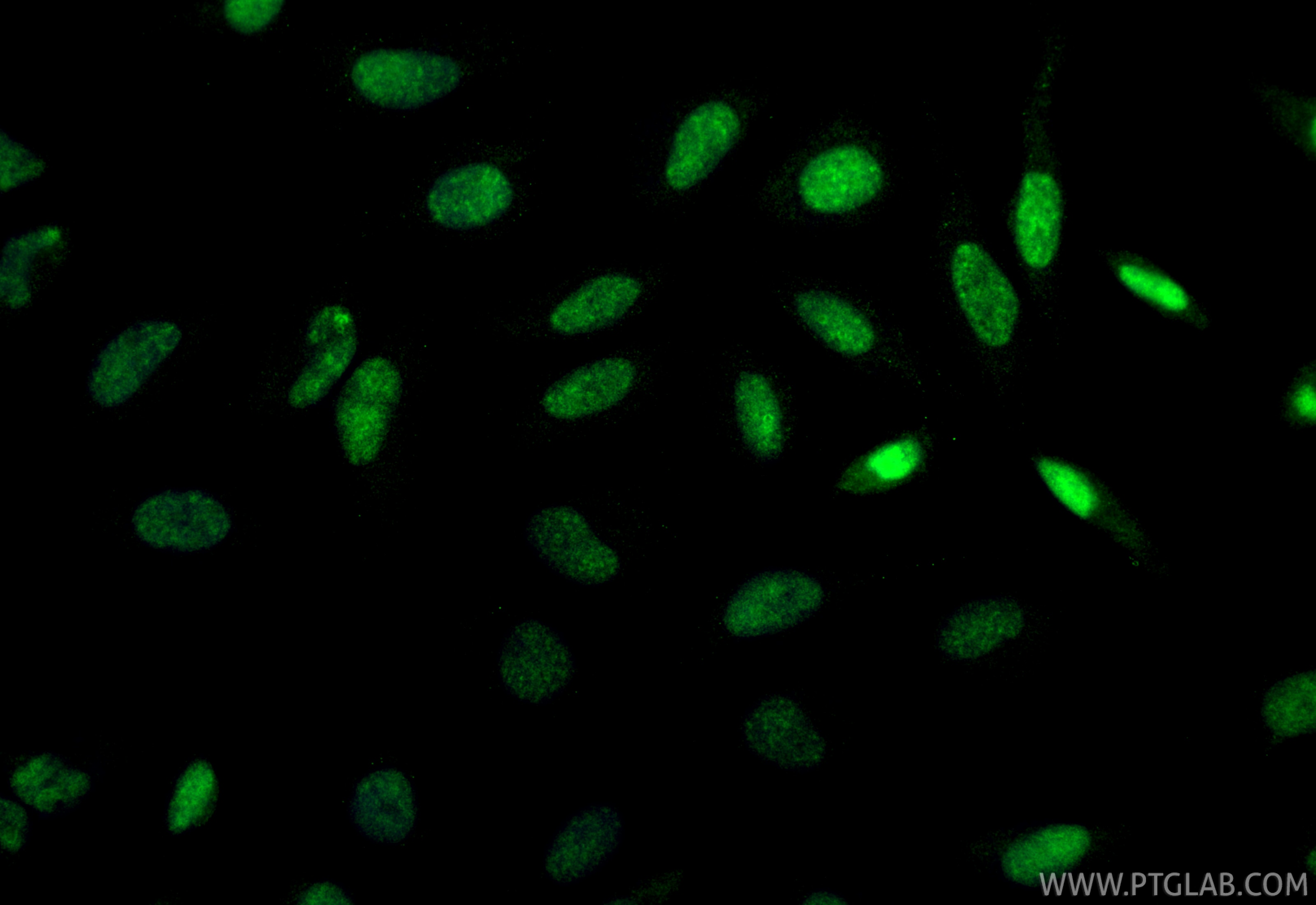 Immunofluorescence (IF) / fluorescent staining of HeLa cells using RAD50 Polyclonal antibody (29390-1-AP)
