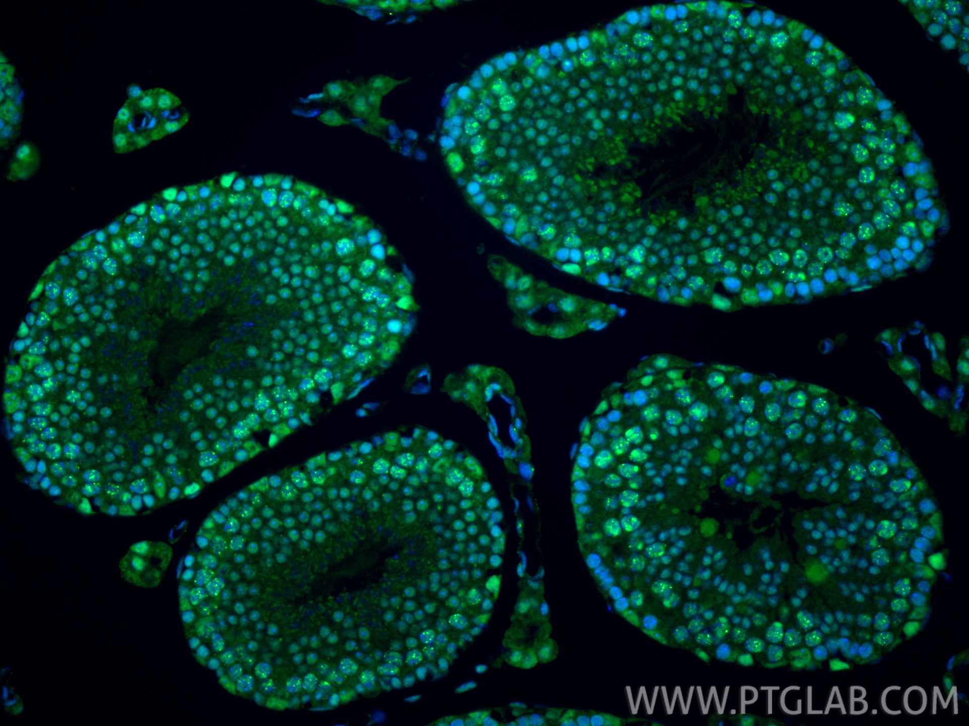 Immunofluorescence (IF) / fluorescent staining of mouse testis tissue using RAD50 Polyclonal antibody (29390-1-AP)