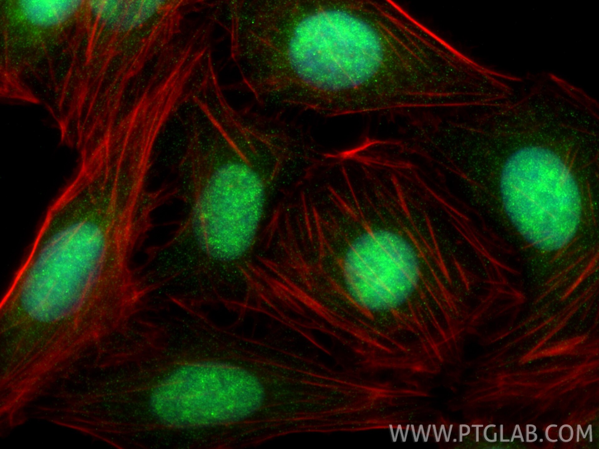 Immunofluorescence (IF) / fluorescent staining of U2OS cells using RAD50 Polyclonal antibody (29390-1-AP)