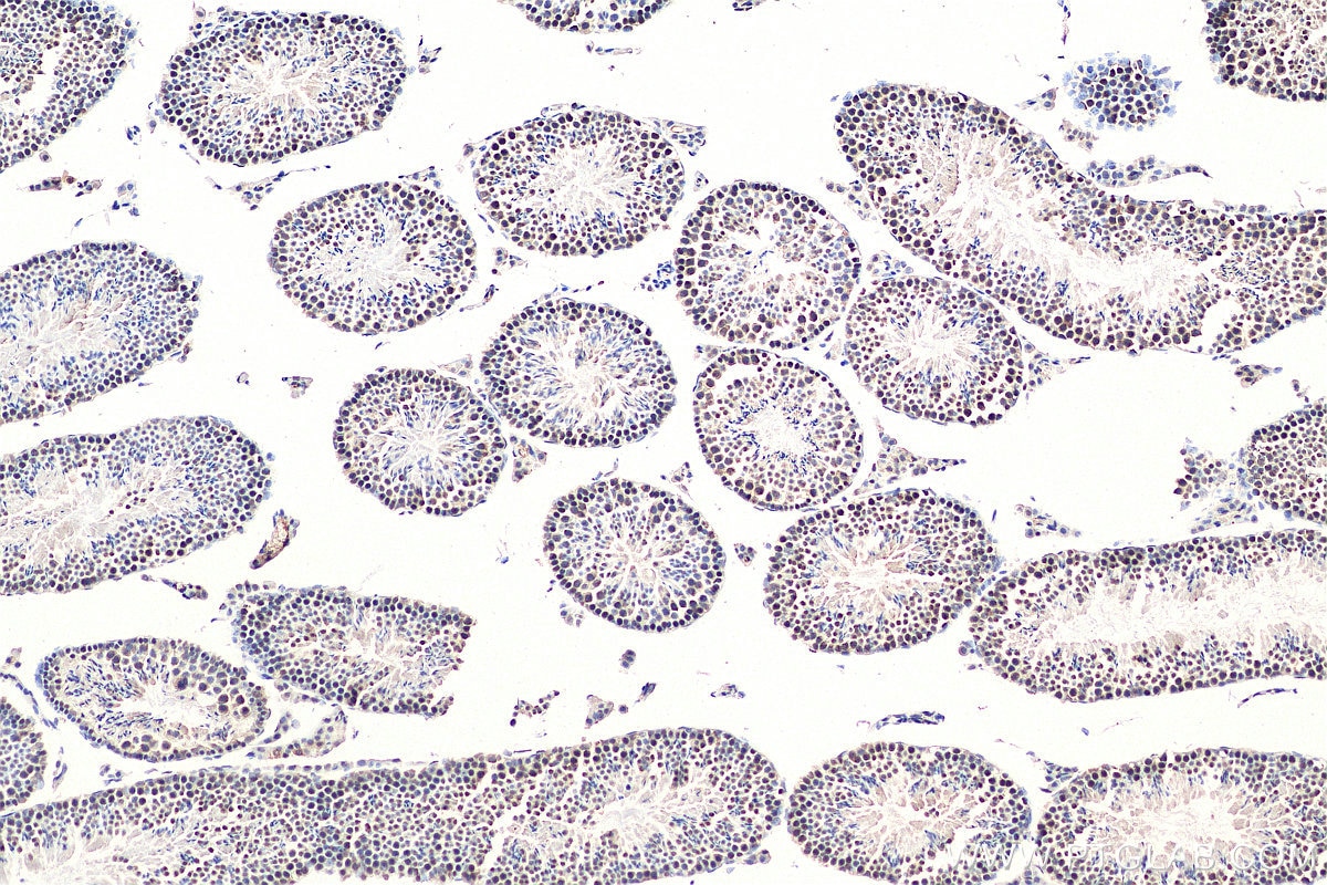 Immunohistochemistry (IHC) staining of mouse testis tissue using RAD50 Polyclonal antibody (29390-1-AP)