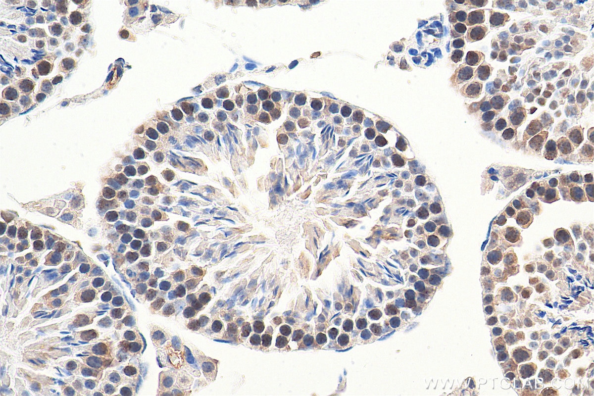 Immunohistochemistry (IHC) staining of mouse testis tissue using RAD50 Polyclonal antibody (29390-1-AP)