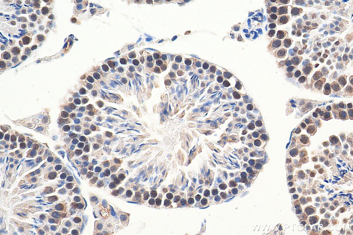 IHC staining of mouse testis using 29390-1-AP