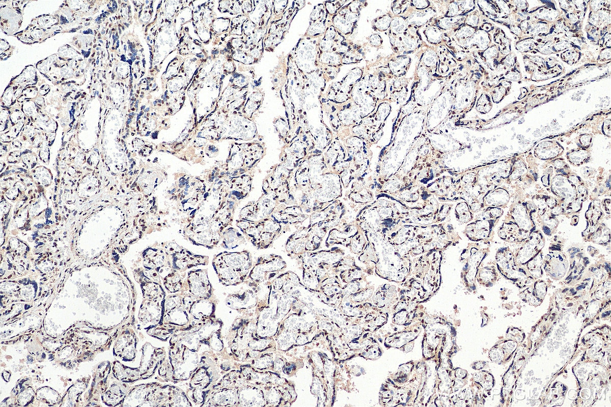 Immunohistochemistry (IHC) staining of human placenta tissue using RAD50 Polyclonal antibody (29390-1-AP)