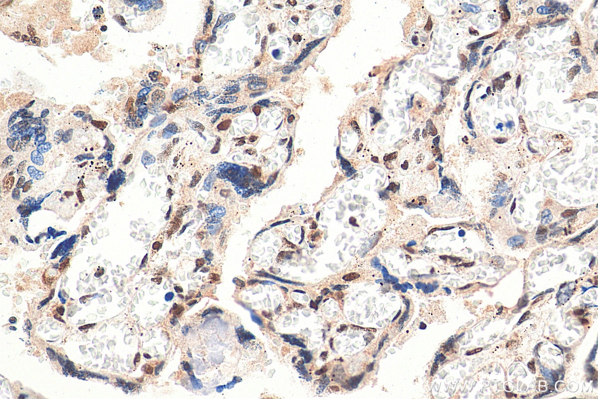 Immunohistochemistry (IHC) staining of human placenta tissue using RAD50 Polyclonal antibody (29390-1-AP)