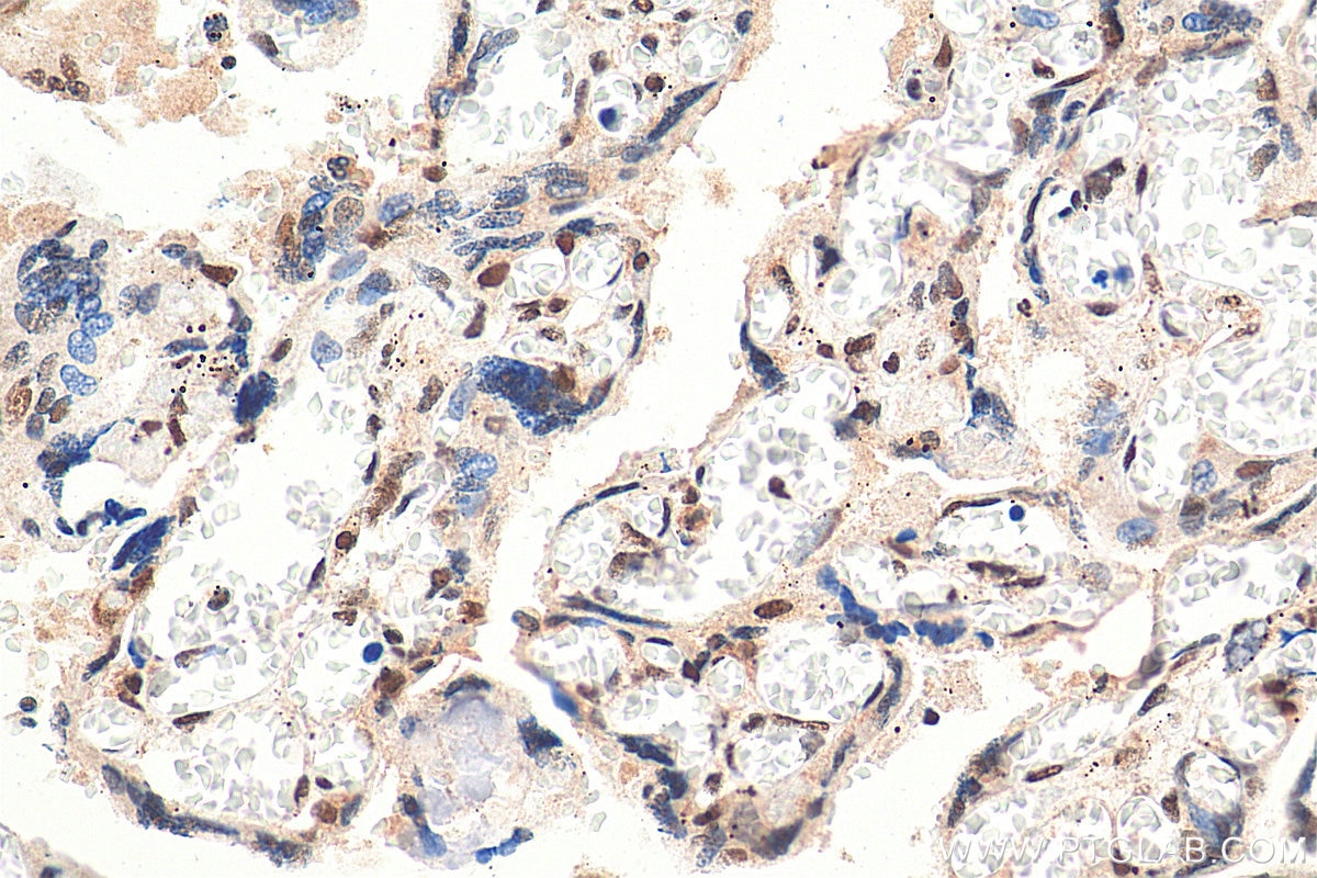 IHC staining of human placenta using 29390-1-AP