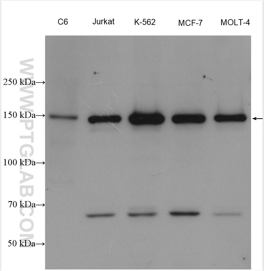 Western Blot (WB) analysis of various lysates using RAD50 Polyclonal antibody (29390-1-AP)