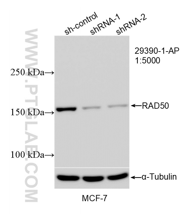 Western Blot (WB) analysis of MCF-7 cells using RAD50 Polyclonal antibody (29390-1-AP)