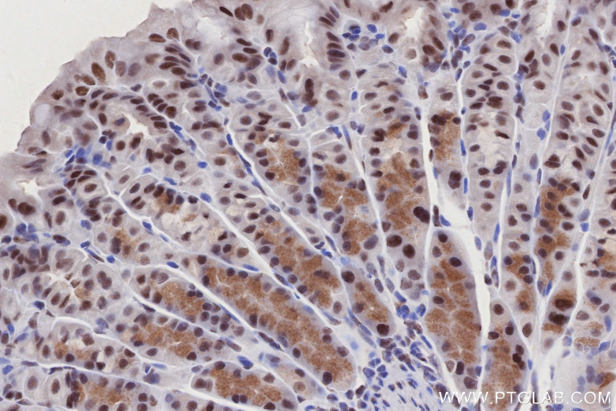 Immunohistochemistry (IHC) staining of mouse stomach tissue using RAD50 Recombinant antibody (84969-4-RR)
