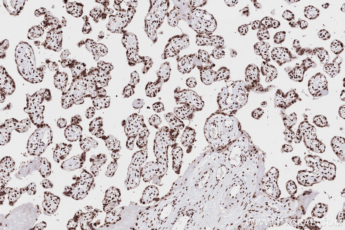Immunohistochemistry (IHC) staining of human placenta tissue using RAD50 Recombinant antibody (84969-4-RR)