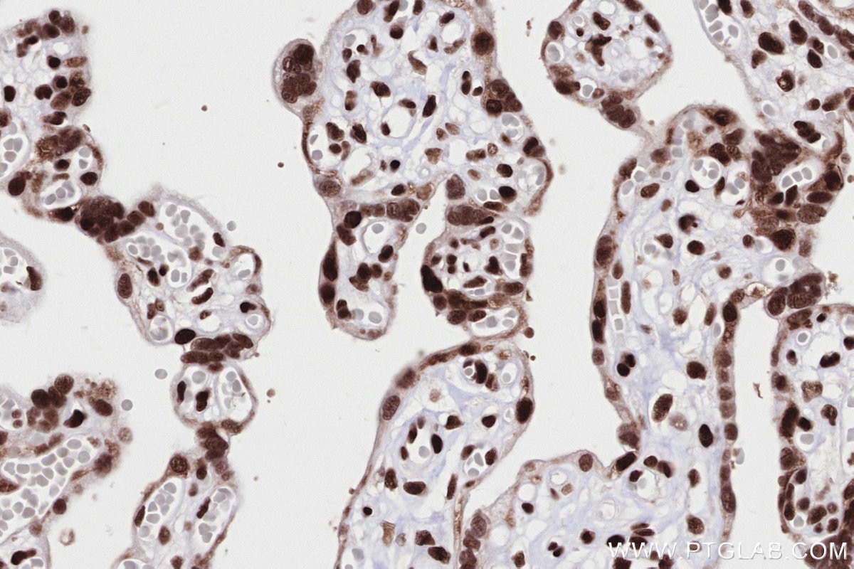 Immunohistochemistry (IHC) staining of human placenta tissue using RAD50 Recombinant antibody (84969-4-RR)