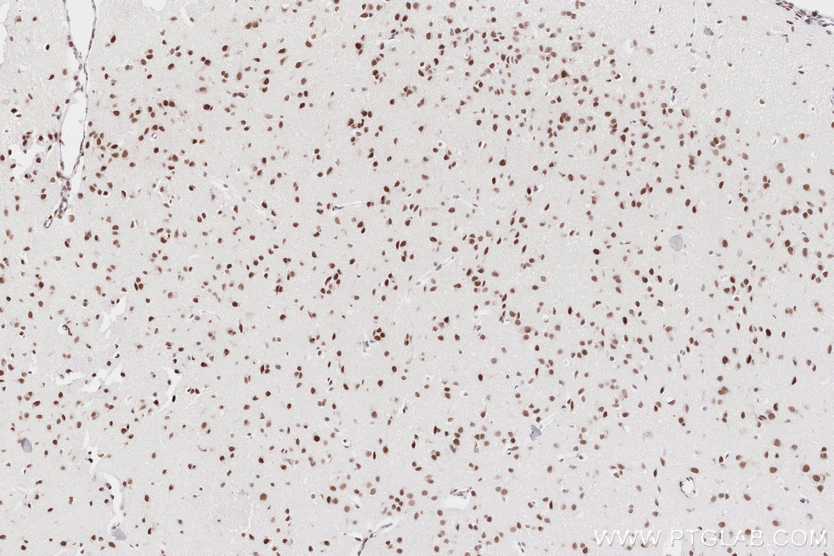Immunohistochemistry (IHC) staining of mouse brain tissue using RAD50 Recombinant antibody (84969-4-RR)