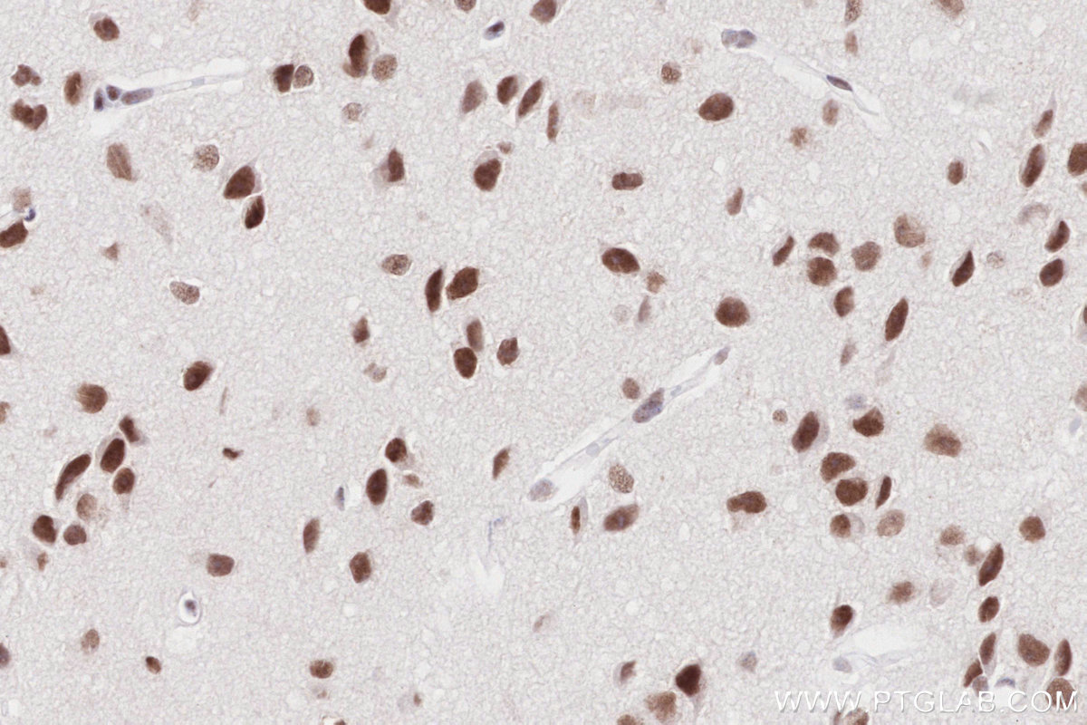 Immunohistochemistry (IHC) staining of mouse brain tissue using RAD50 Recombinant antibody (84969-4-RR)