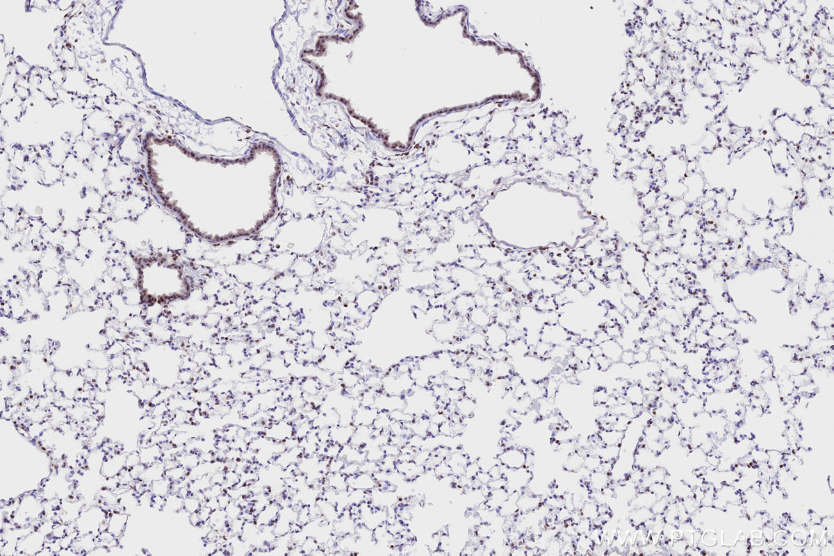 Immunohistochemistry (IHC) staining of mouse lung tissue using RAD50 Recombinant antibody (84969-4-RR)