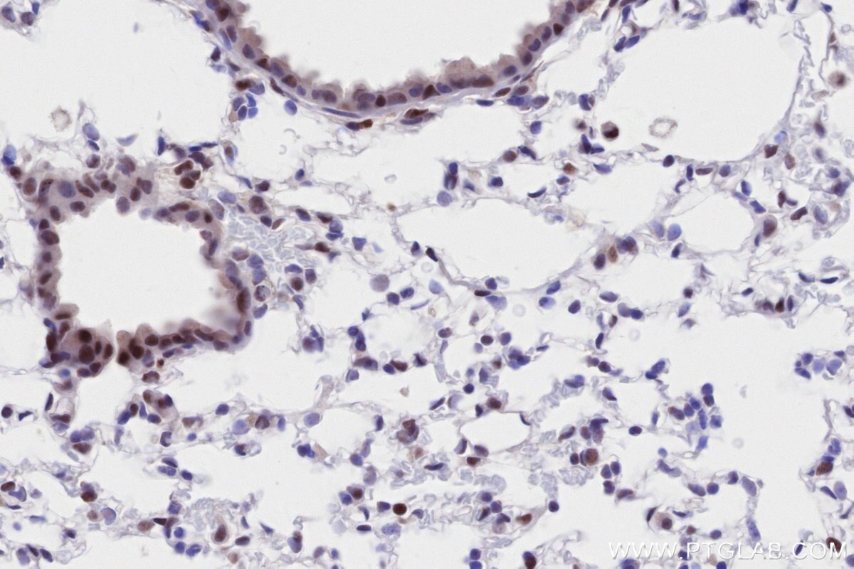 Immunohistochemistry (IHC) staining of mouse lung tissue using RAD50 Recombinant antibody (84969-4-RR)