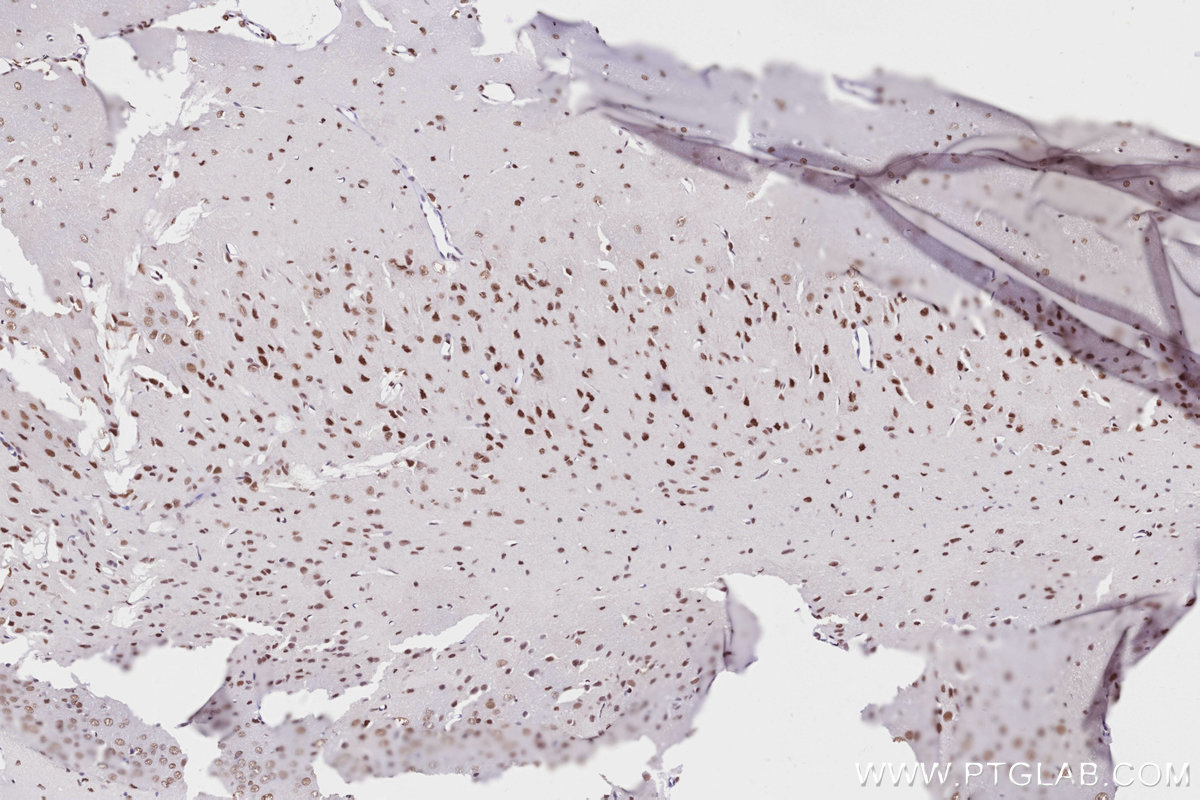 Immunohistochemistry (IHC) staining of rat brain tissue using RAD50 Recombinant antibody (84969-4-RR)