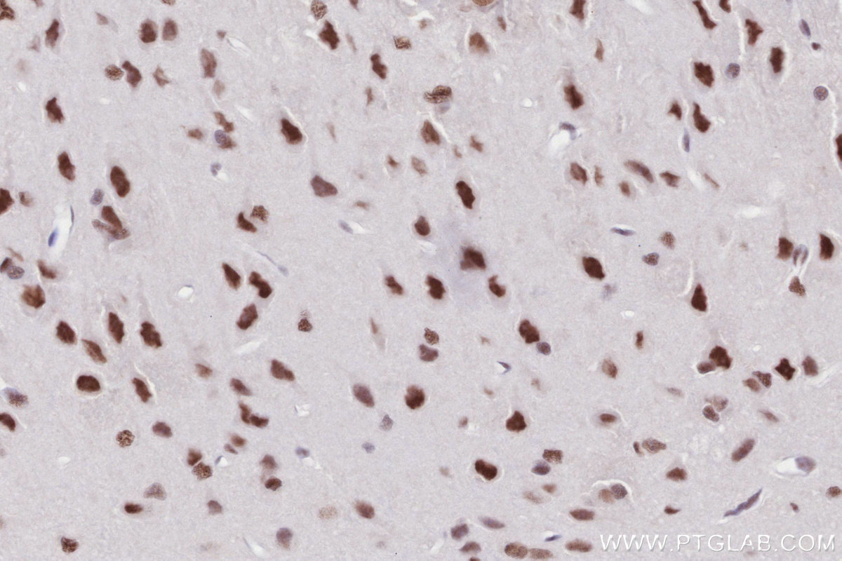 Immunohistochemistry (IHC) staining of rat brain tissue using RAD50 Recombinant antibody (84969-4-RR)