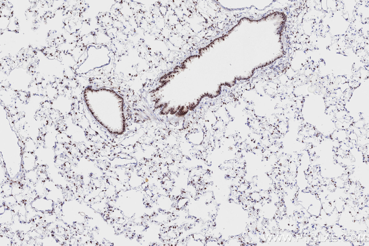 Immunohistochemistry (IHC) staining of rat lung tissue using RAD50 Recombinant antibody (84969-4-RR)