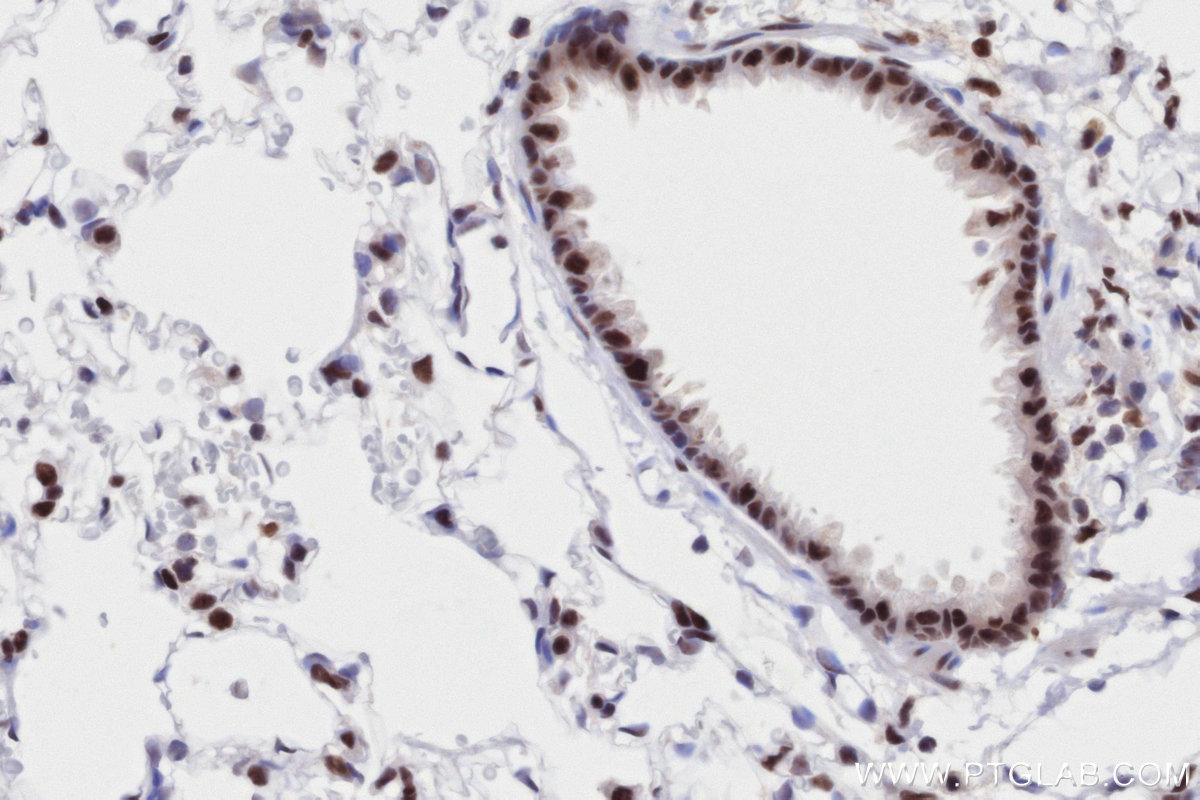 Immunohistochemistry (IHC) staining of rat lung tissue using RAD50 Recombinant antibody (84969-4-RR)