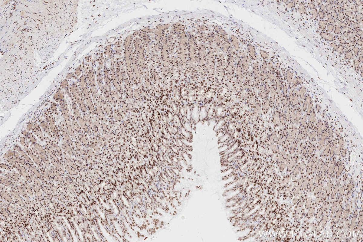 Immunohistochemistry (IHC) staining of rat stomach tissue using RAD50 Recombinant antibody (84969-4-RR)