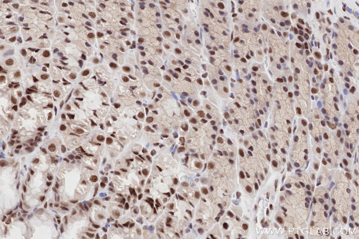 Immunohistochemistry (IHC) staining of rat stomach tissue using RAD50 Recombinant antibody (84969-4-RR)