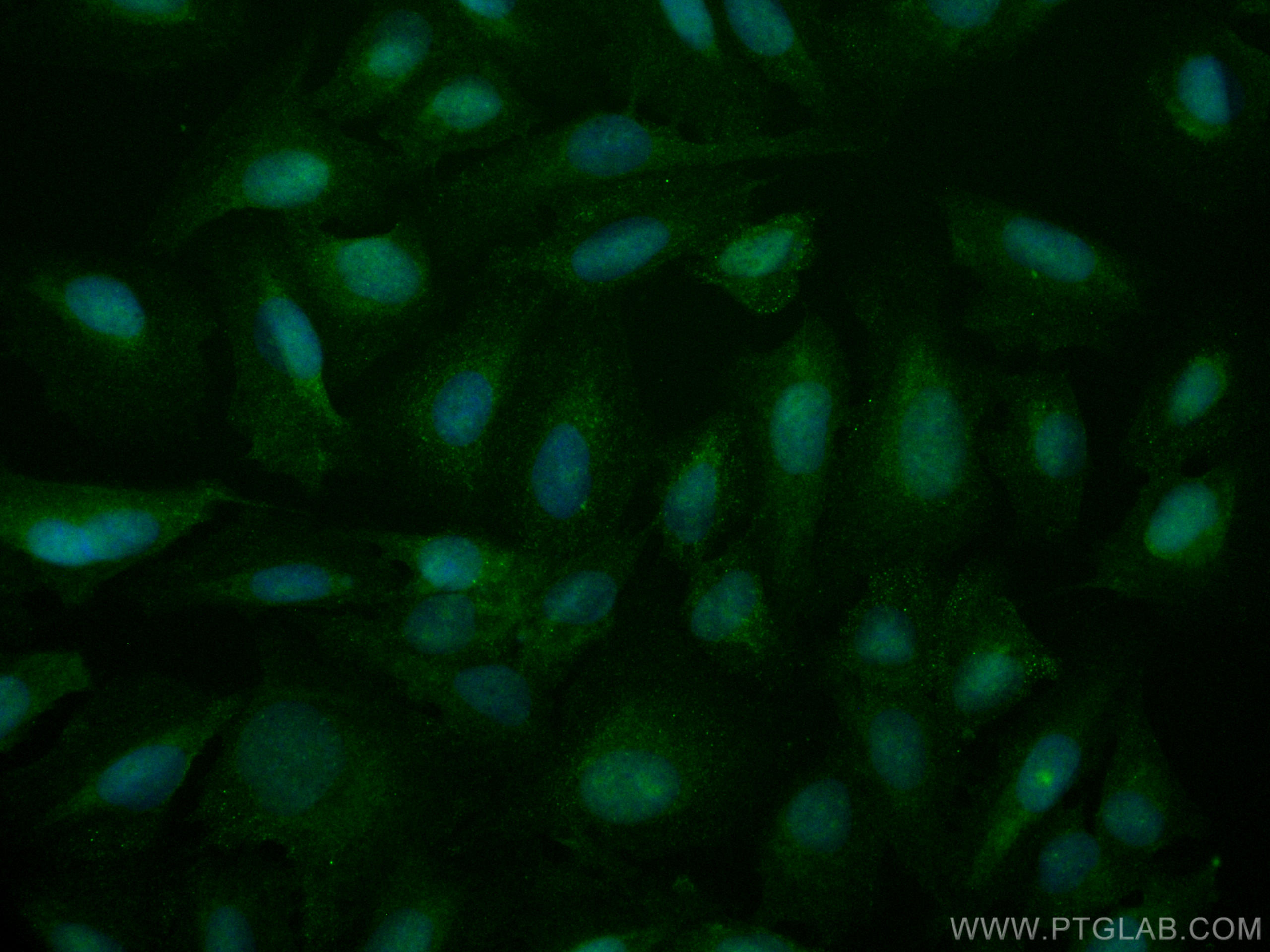 Immunofluorescence (IF) / fluorescent staining of U2OS cells using CoraLite® Plus 488-conjugated RAD50 Polyclonal ant (CL488-29390)