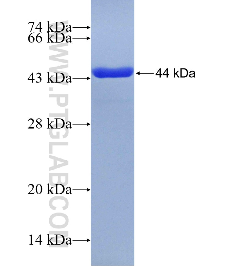 RAD50 fusion protein Ag29949 SDS-PAGE