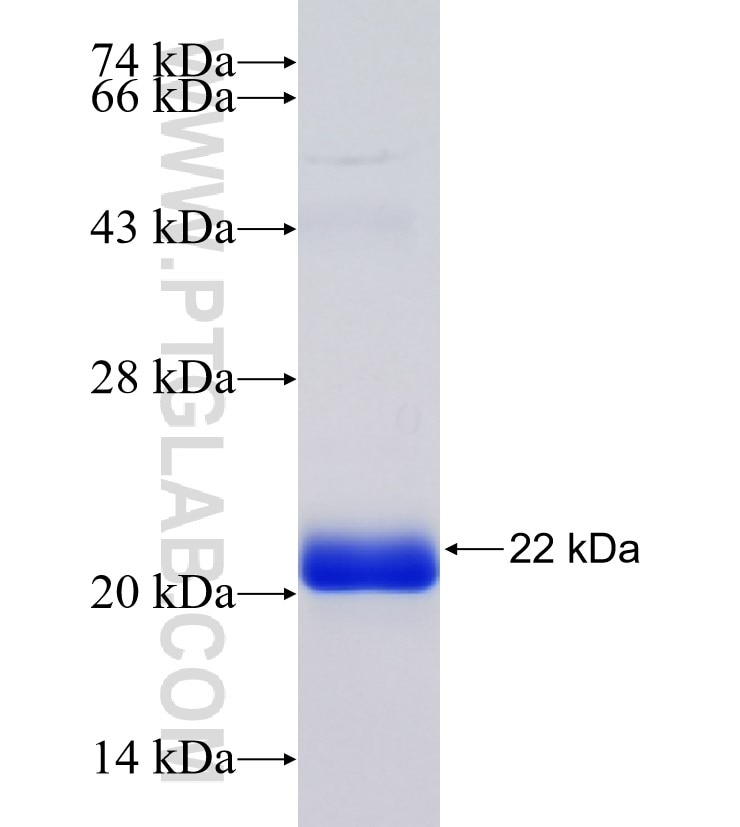 RAD50 fusion protein Ag34589 SDS-PAGE
