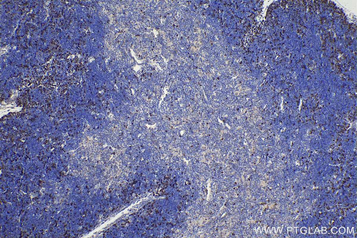 Immunohistochemistry (IHC) staining of mouse thymus tissue using RAD51 Polyclonal antibody (14961-1-AP)