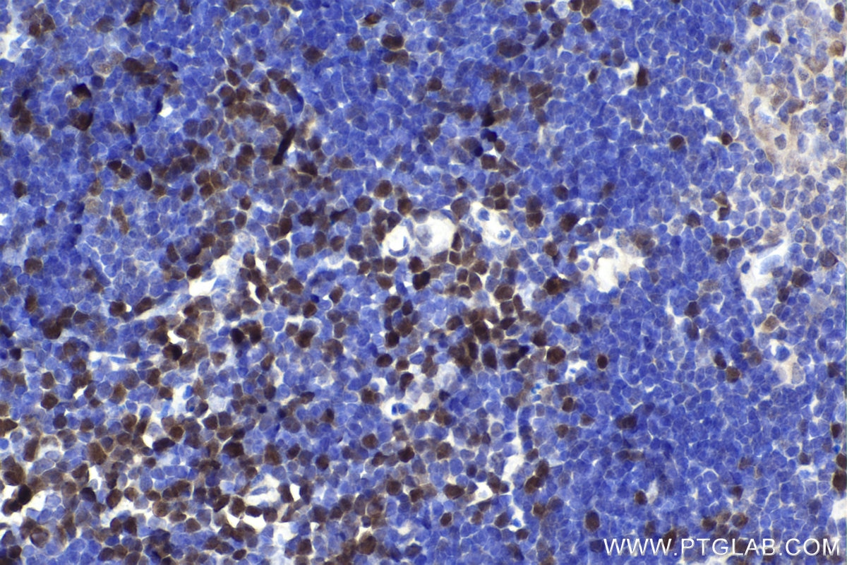 Immunohistochemistry (IHC) staining of mouse thymus tissue using RAD51 Polyclonal antibody (14961-1-AP)