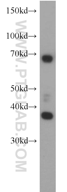 Western Blot (WB) analysis of HeLa cells using RAD51 Polyclonal antibody (14961-1-AP)