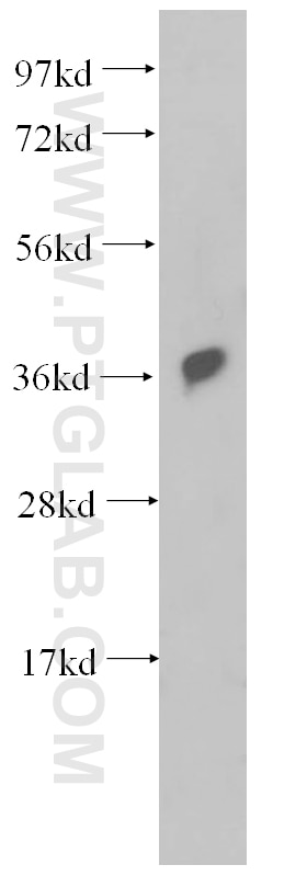 Western Blot (WB) analysis of HeLa cells using RAD51 Polyclonal antibody (14961-1-AP)