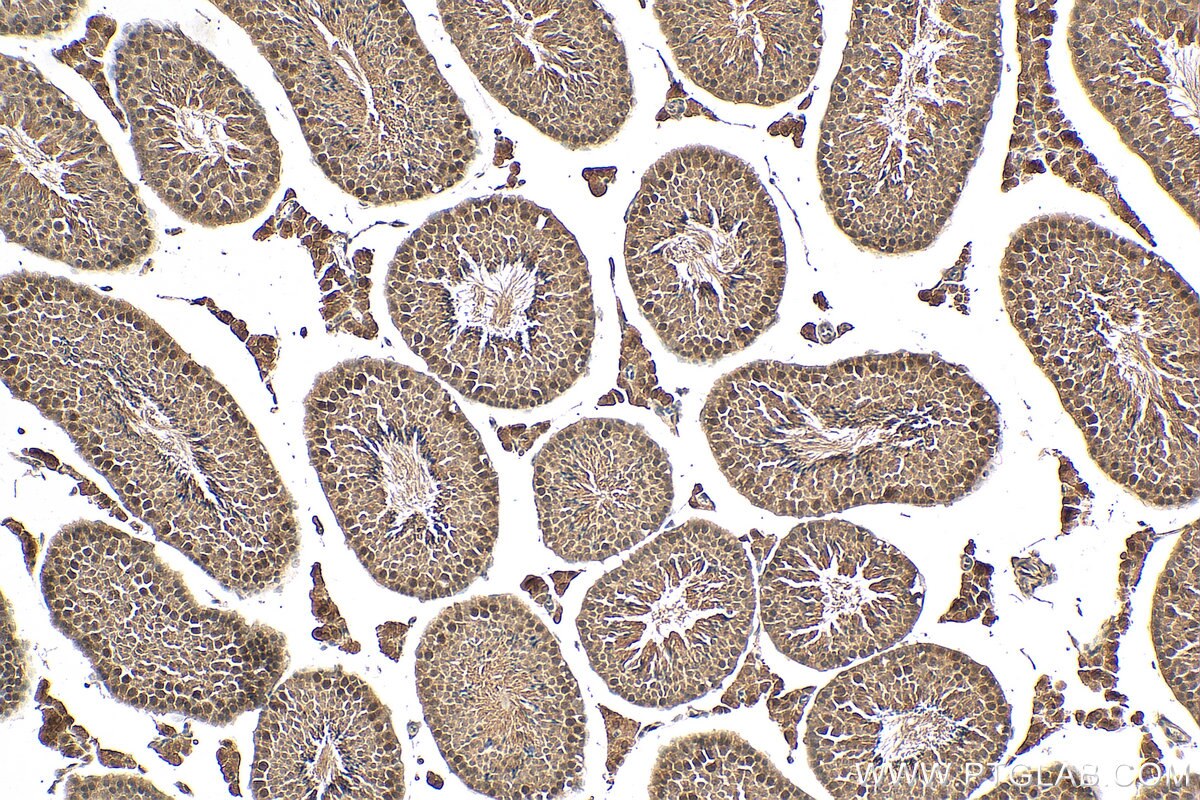 IHC staining of mouse testis using 67024-1-Ig