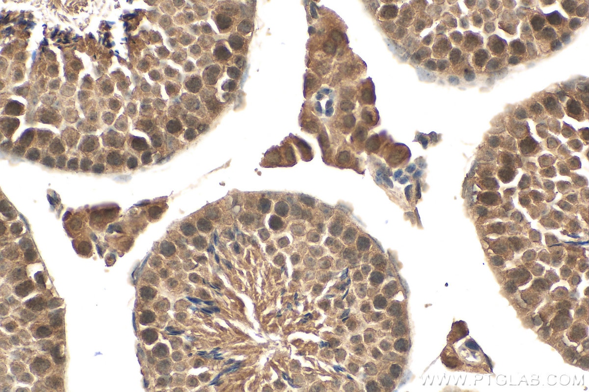 Immunohistochemistry (IHC) staining of mouse testis tissue using RAD51 Monoclonal antibody (67024-1-Ig)