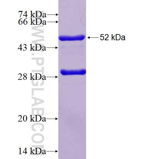 RAD51 fusion protein Ag6823 SDS-PAGE