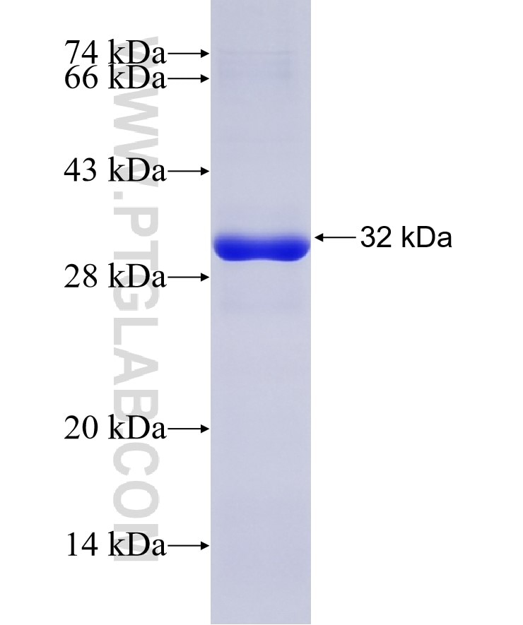 RAD51 fusion protein Ag7410 SDS-PAGE
