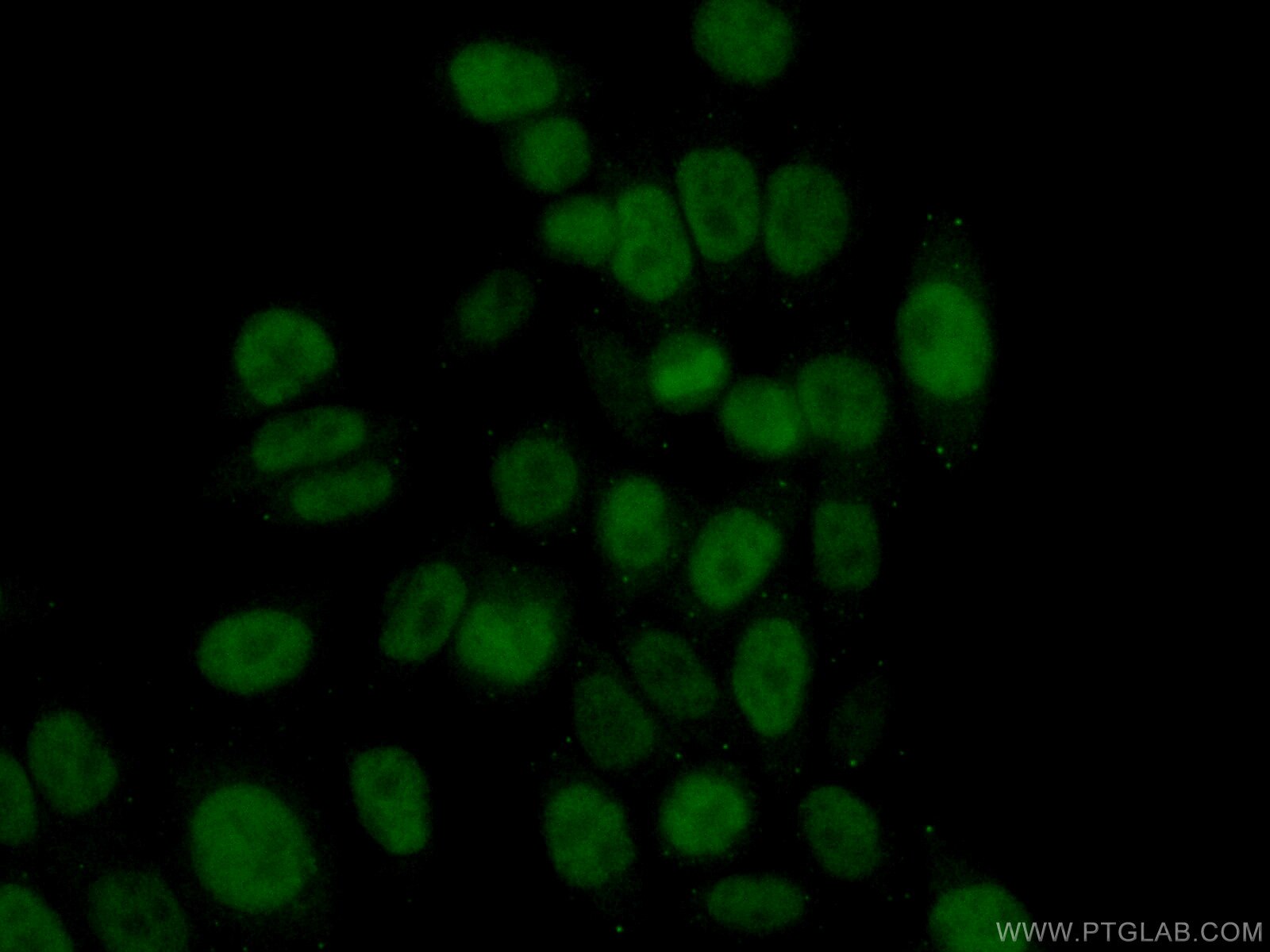 Immunofluorescence (IF) / fluorescent staining of HeLa cells using RAD51AP1 Polyclonal antibody (11255-1-AP)