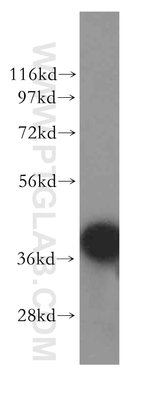 WB analysis of human brain using 11255-1-AP