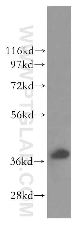 Western Blot (WB) analysis of human brain tissue using RAD51AP1 Polyclonal antibody (11255-1-AP)