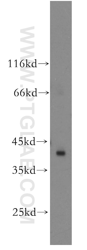 WB analysis of HeLa using 13555-1-AP