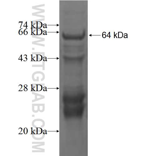 RAD51L1 fusion protein Ag3884 SDS-PAGE RAD51L1 fusion protein Ag3884 SDS-PAGE