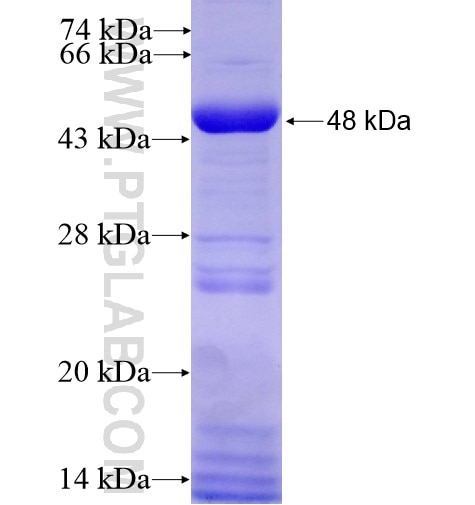 RAD51L1 fusion protein Ag4412 SDS-PAGE