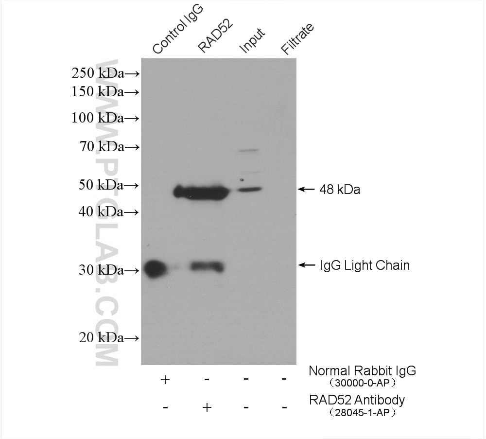 Immunoprecipitation (IP) experiment of HEK-293 cells using RAD52 Polyclonal antibody (28045-1-AP)