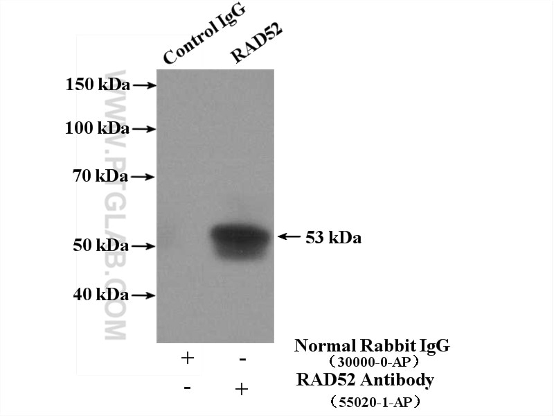Immunoprecipitation (IP) experiment of PC-3 cells using RAD52 Polyclonal antibody (55020-1-AP)