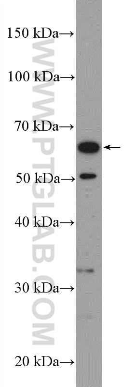 Western Blot (WB) analysis of PC-3 cells using RAD52 Polyclonal antibody (55020-1-AP)