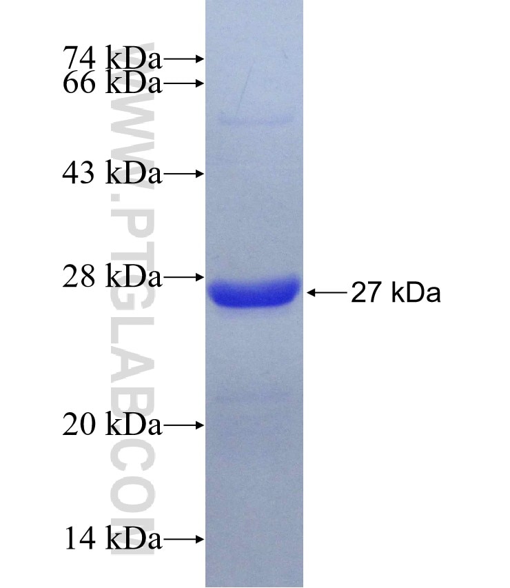 RAD52 fusion protein Ag27665 SDS-PAGE