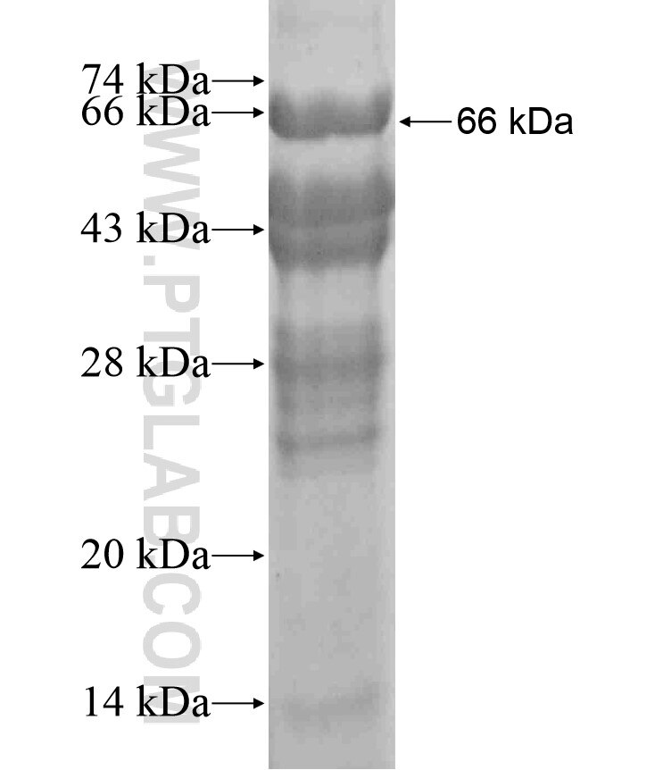 RAD54L2 fusion protein Ag17995 SDS-PAGE RAD54L2 fusion protein Ag17995 SDS-PAGE