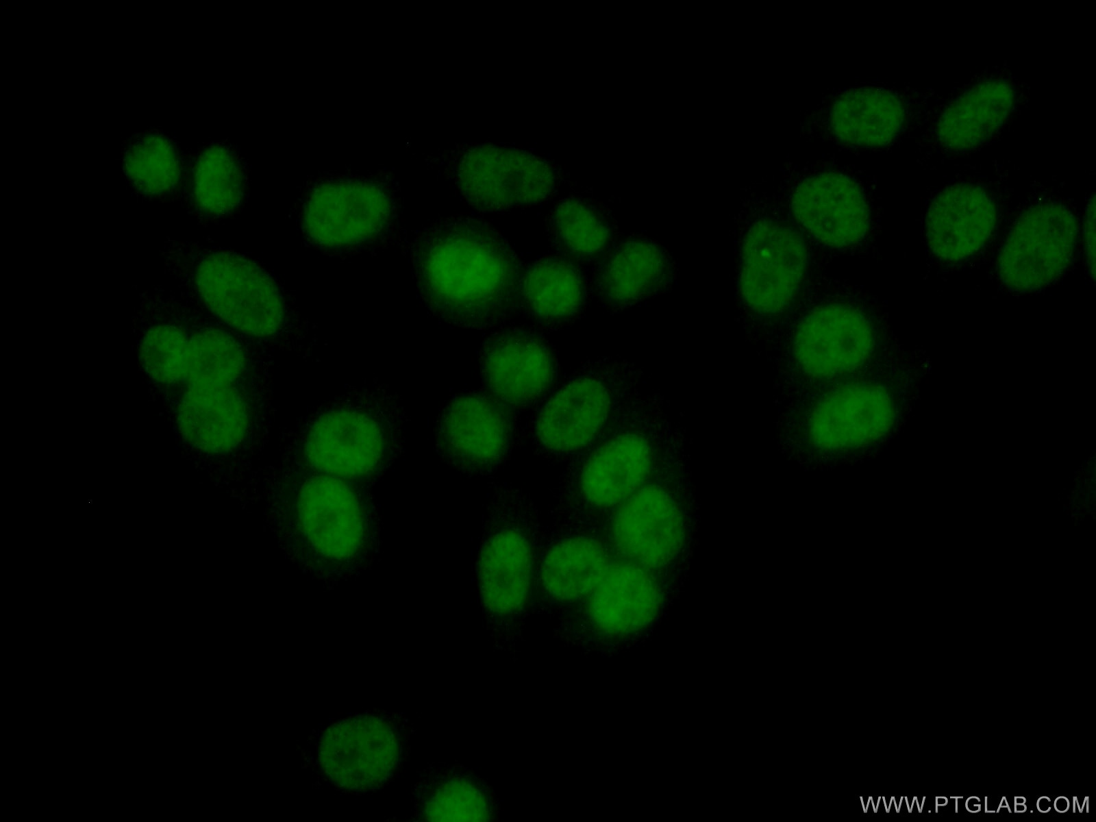 Immunofluorescence (IF) / fluorescent staining of HeLa cells using RAD9A Polyclonal antibody (13035-1-AP)