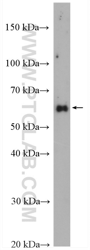 Western Blot (WB) analysis of A549 cells using RAD9A Polyclonal antibody (13035-1-AP)