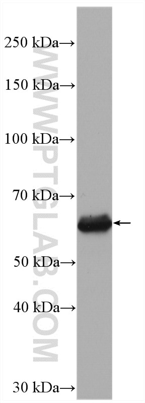 Western Blot (WB) analysis of HeLa cells using RAD9A Polyclonal antibody (13035-1-AP)